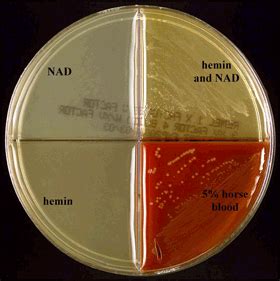 haemophilus quad plate chart